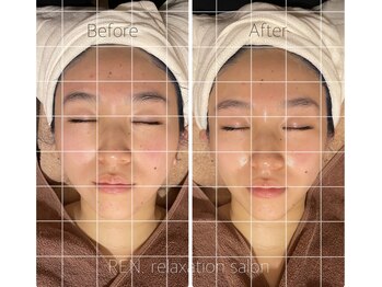 レン サロン(REN.)/整体×フェイシャル【小顔矯正】