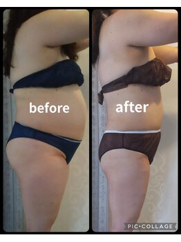 ラキュア(La Cure)/ダイエットもお任せ下さい