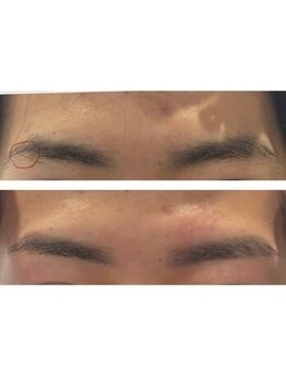 メンズ眉毛サロンラボ 横浜西口店/毛が生えていない部分がある！