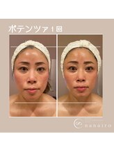 ナナイロ(nanairo)/ポテンツァ×エクソソーム 