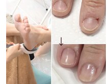 アネラ(ANERA)の雰囲気（自爪のコンプレックス改善！爪質改善育成ケア＆足裏角質極上ケア）