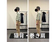 カワル整体 長嶺院/猫背・巻き肩