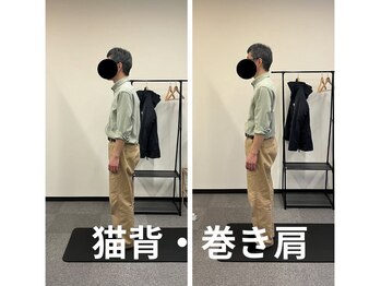 カワル整体 長嶺院/猫背・巻き肩