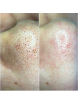 ウェリナ(Welina)/