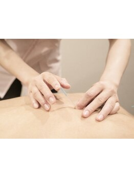 鍼灸施術を受けたい