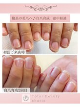 カリス(charis)/自爪育成