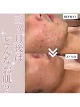 サロンドゥルシエル/【集中パーソナルケア】