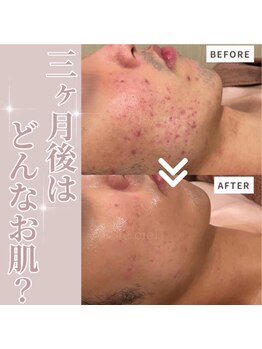 サロンドゥルシエル/【集中パーソナルケア】