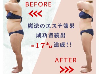 グレイスボディ BiViつくば店(Grace Body)/体質に合ったオーダーメイド施術