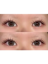 シュピネ(Choupinet)/エクパーマ140本