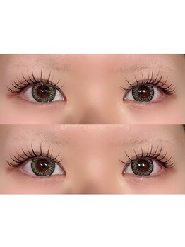 シュピネ(Choupinet)/エクパーマ140本