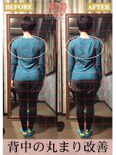 ヴィオーデ 新宿店/小顔、リンパ、ヘッドスパ、骨盤