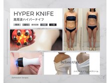 ゼクサースポーツスタジオ(ZEXER SPORTS STUDIO)の雰囲気（【ハイパーナイフ正規取扱店】ボディとフェイシャルで引き締め）