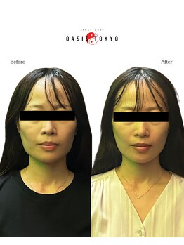 ネオオアシストウキョウ(ネオ OASIS TOKYO)/