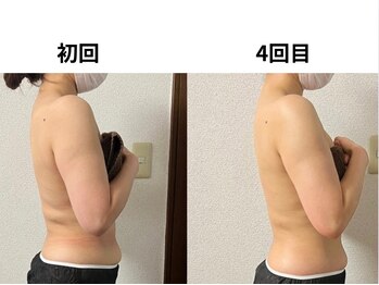 ティーズルーム(T's Room)/巻き肩矯正&痩身