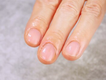 モアナ(MOANA)の写真/かさつきのある指先・足元もとっておきの《角質ケア》でうるおいのある柔らかな肌に♪