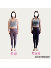 フォーシー(4C)/Before/After