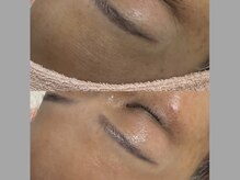 リル シャイン(Rill SHINE)/