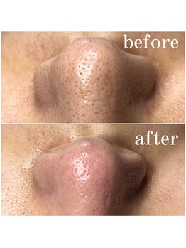 ティーツリー 名古屋 桜山(Tea Tree)/暑くなってきました、、