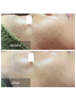 マリー(Mary.)/アンストレス