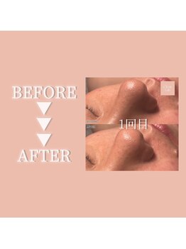 クリアラボ 日本橋(Clear Lab)/Before＆After