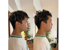 けんたろう鍼灸院の雰囲気(美容鍼のビフォーアフター)