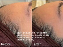 フルリール(FLEURIR)の雰囲気（つやっとした透明感、内側から輝くような水光肌を目指せます☆）
