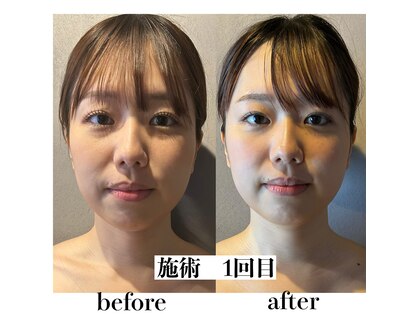 かたりべの写真