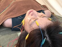 久心宝鍼灸院/通電美容鍼