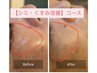 【シミ/くすみ改善♪】美白・エイジングケア幹細胞導入60分¥13000→¥9800