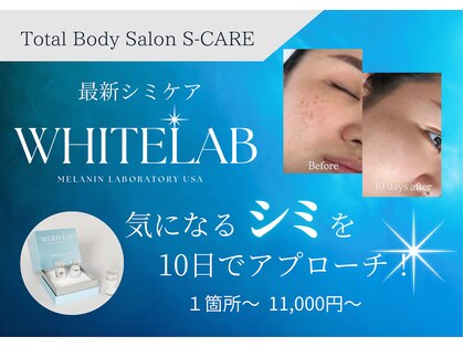 エスケア(S-CARE)の写真