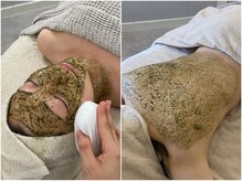 ソフ(soph.)の雰囲気（#剥けないハーブピーリング #肌質改善 #ニキビケア #毛穴）