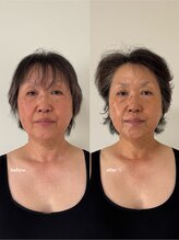 こつこつラボ サンイチマル オオル(310/OOL') 施術 美容整体