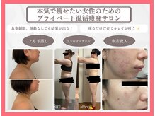 ヨサパーク ベル(YOSA PARK Belle)