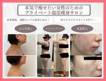 ヨサパーク ベル(YOSA PARK Belle)