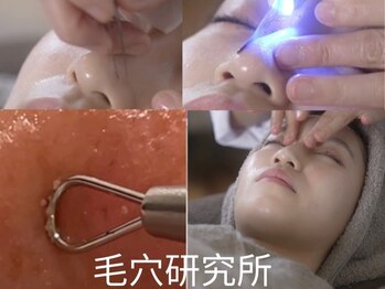 毛穴研究所の写真/《結果重視の毛穴特化サロン》毛穴を研究し続けるオーナーによる独自技術★いちご鼻,黒ずみ,毛穴詰まりに