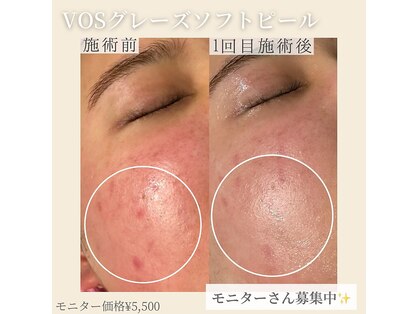 スイッチプラス(switch+)の写真