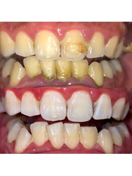 セルフホワイトニングサロン origin 大分王子店/