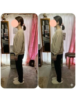 ララスマイル 鶴崎森町店/頭の位置が安定し、軽くなった