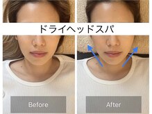 ラヴァンド(Lavande)の雰囲気（顔に触れず小顔ケアも同時に◎フェイスラインもスッキリ♪）