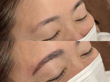 ビクシー(vixxcy)/レディース ビフォーアフター