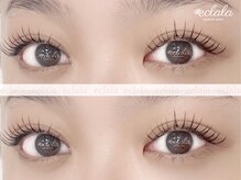 エクララ(eclala)/まつ毛エクステ140本