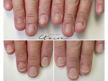 トイロ(toiro)の写真/見られないように隠していた爪が《120分後には人前で堂々と見せられる指先へ》
