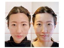 小顔22 ボルティ 本店(Bolty)/面長矯正