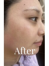 エリス(ELISSE)/After