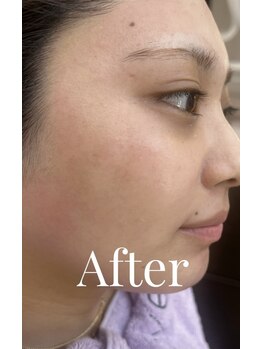 エリス(ELISSE)/After