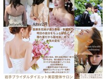 ビルーチェ(美LUCE)