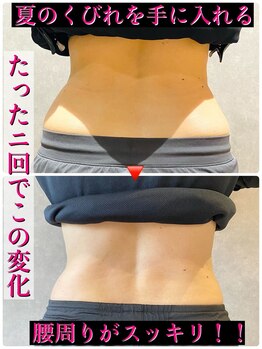 ヒーレンス(HEALENCE)/内臓矯正でスリムなお腹へ!