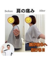 三条かがやき整体院/肩の痛み改善