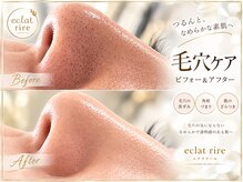 エクラリール(eclat rire)